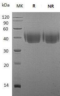 Mouse Cd226/Pta1 (His tag) recombinant protein
