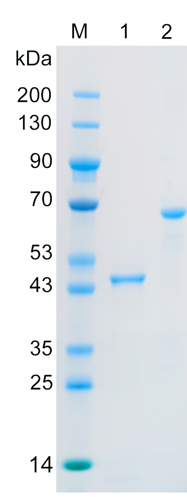 Recombinant GOG8N protein (His tag) SDS-PAGE
