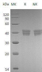 Human HTRA2/OMI/PRSS25 (His tag) recombinant protein