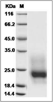 Mouse GM-CSF / CSF2 Protein (His Tag) SDS-PAGE