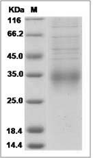 Rat CD28 / TP44 Protein (His Tag)