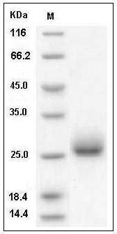 Mouse Ephrin-A4/EFNA4 (His Tag) recombinant protein