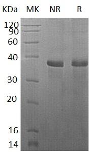 Human ACTR8/ARP8/INO80N (His tag) recombinant protein