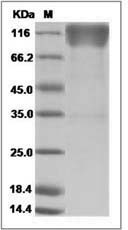 Human CEACAM1 / CD66a Protein (His & Fc Tag)
