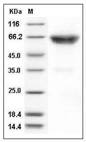 Mouse TNFR2 / CD120b / TNFRSF1B Protein (Fc Tag) SDS-PAGE