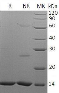 Human HDGF/HMG1L2 (His tag) recombinant protein