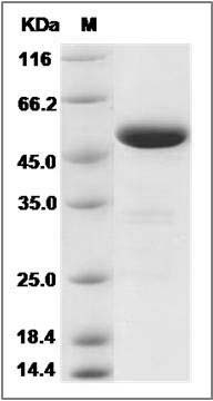 Human PNLIP Protein (His Tag) SDS-PAGE