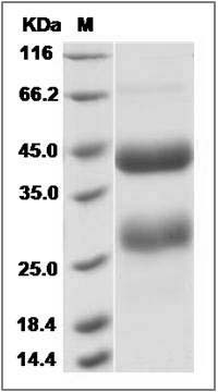 Influenza A H7N9 (A/Anhui/1/2013) Hemagglutinin / HA Protein (HA1+HA2, cleavage) (His Tag) SDS-PAGE