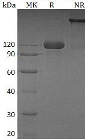 Human SEMA4B/KIAA1745/SEMAC (Fc & His tag) recombinant protein