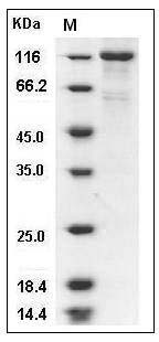 Human EPOR & CD131 Homodimer Protein SDS-PAGE