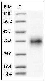 Mouse TNFR1 / CD120a / TNFRSF1A Protein (His Tag) SDS-PAGE