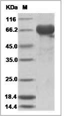 Influenza B (B/Brisbane/60/2008) Hemagglutinin / HA1 Protein (His Tag)