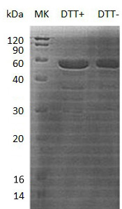 Human RTN4/KIAA0886/NOGO/My043/SP1507 (GST tag) recombinant protein