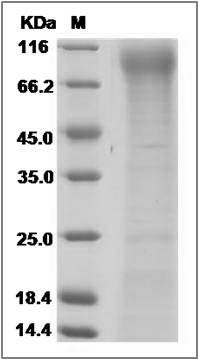 Mouse FLT-3 / CD135 / FLK-2 Protein (His Tag) SDS-PAGE