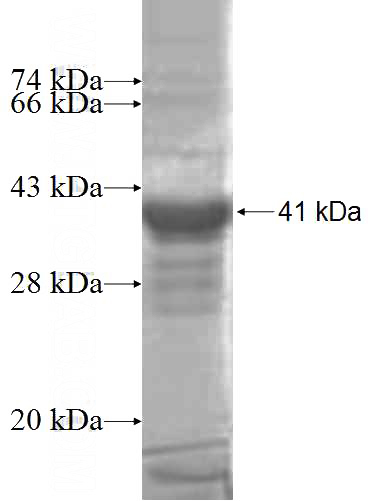 Human CNDP2 Recombinant protein (6*His tag)