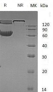Mouse Efnb1/Epl2/Eplg2/Lerk2/Stra1 (Fc & His tag) recombinant protein