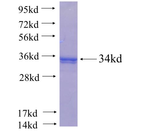 Recombinant Arabidopsis thaliana CHI SDS-PAGE