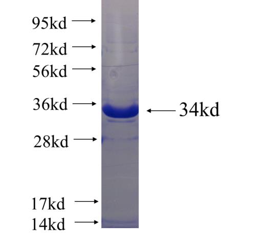 Recombinant human CCDC7 SDS-PAGE