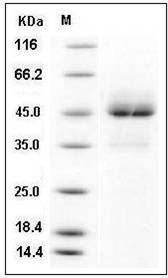 Human TRAIL R1 / CD261 / TNFRSF10A Protein (Fc Tag) SDS-PAGE