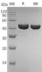 E.coli trpB/b1261/JW1253 recombinant protein