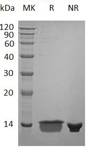 Human MIA (His tag) recombinant protein
