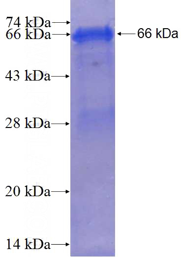 Recombinant Human MTHFD1 SDS-PAGE