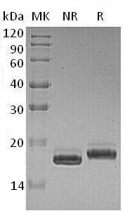 Human IFNA6 (His tag) recombinant protein