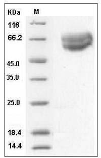 Human IL18R1 / CD218a Protein (His Tag) SDS-PAGE