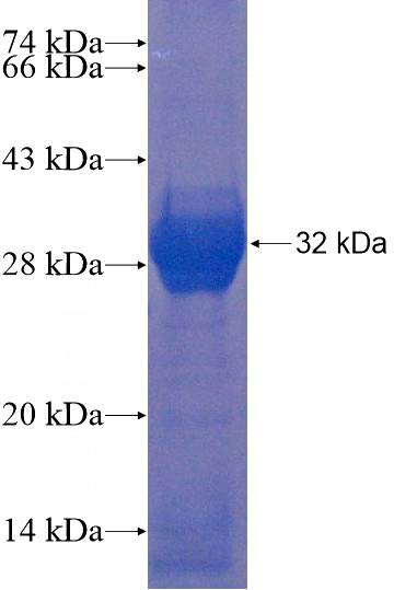 Recombinant Human GPR115 SDS-PAGE
