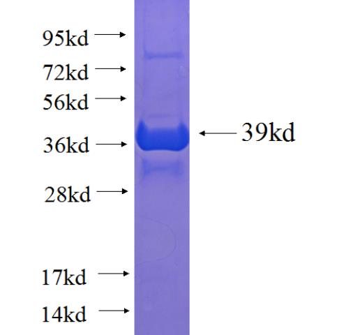 Recombinant human SCOC SDS-PAGE