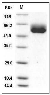 Human IL1RL1 / ST2 Protein (isoform a, His Tag) SDS-PAGE