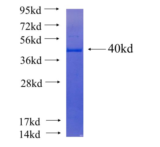 Recombinant human C20orf112 SDS-PAGE