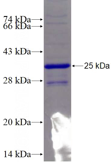 Recombinant Human TEPP SDS-PAGE