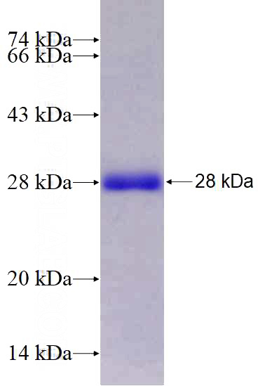 Recombinant Human SERPINA9 SDS-PAGE