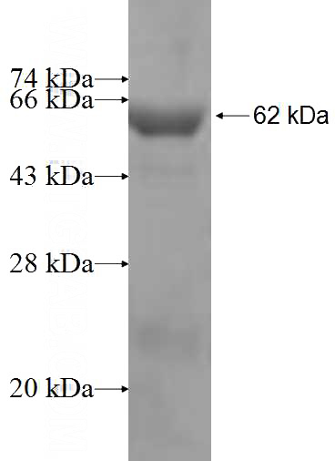 Recombinant Human ATP6V1B1 SDS-PAGE