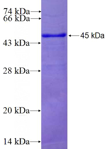 Recombinant Human MPHOSPH6 SDS-PAGE