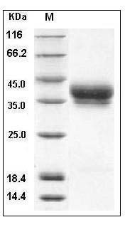 Human CD157 / BST1 Protein (His Tag) SDS-PAGE