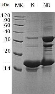 Human TAC3/NKNB/UNQ585/PRO1155 (His tag) recombinant protein