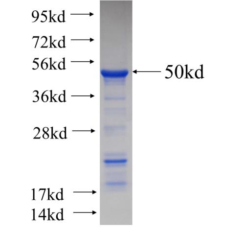 Recombinant Arabidopsis thaliana AtUVR8 SDS-PAGE