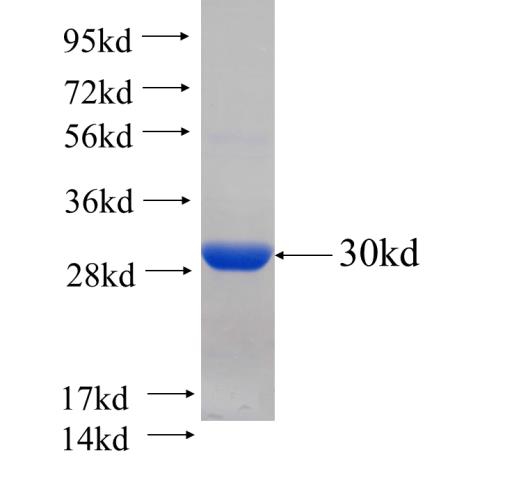 Recombinant Arabidopsis thaliana ATDHAR1 SDS-PAGE