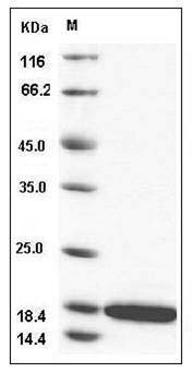 Human CCL21 / 6Ckine Protein SDS-PAGE