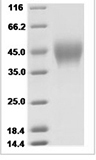 Human IFNAR2 / IFNABR Protein (His Tag), Biotinylated