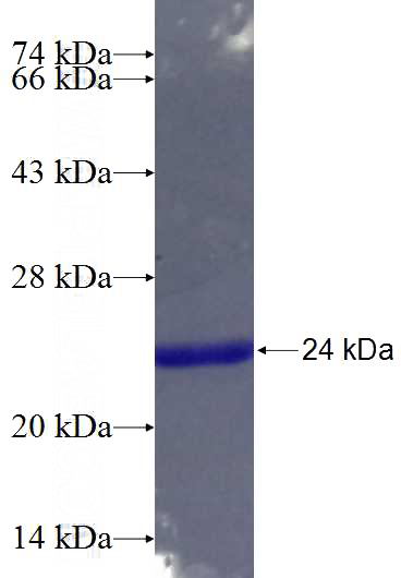 Recombinant Human SH3BP5L SDS-PAGE