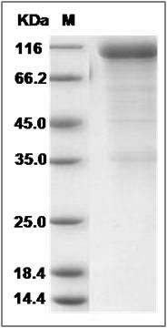 Rat CD36 / SCARB3 Protein (Fc Tag) SDS-PAGE
