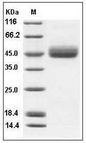 Mouse IL13RA2 / CD213A2 Protein (His Tag) SDS-PAGE