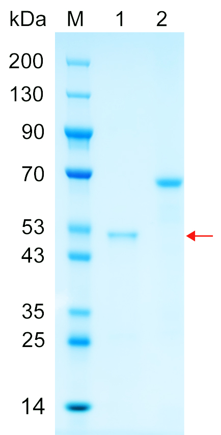 Recombinant KLDC2 protein (His tag) SDS-PAGE