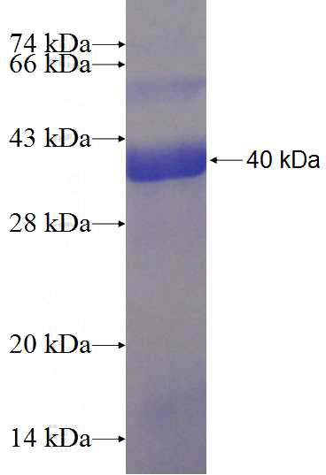 Recombinant Human ATP5A1 SDS-PAGE