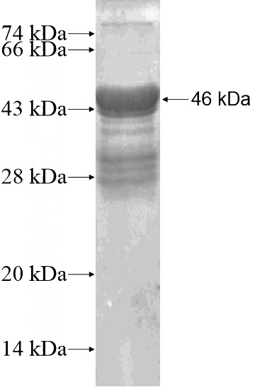 Recombinant Human HOXC5 SDS-PAGE