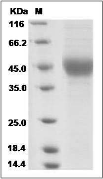 Cynomolgus IL-21R / Interleukin-21 Receptor Protein (His Tag) SDS-PAGE