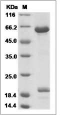 Rat B7-H6 / B7H6 / NCR3LG1 Protein (Fc Tag)